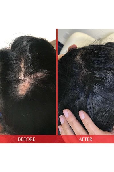 HAIRtamin تركيبة متقدمة 30 كبسولة نباتية - فيتامين للشعر
