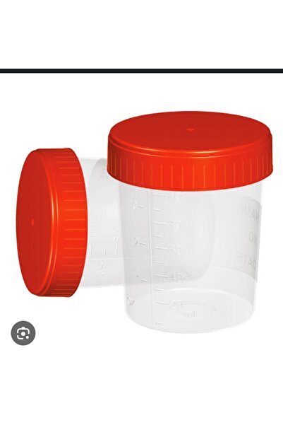 can medikal İdrar kabı tit kabı 200 adet non steril numune kabı