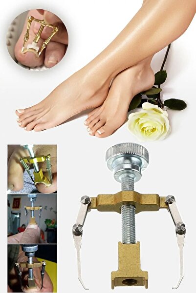 Genel Markalar Batık Tırnak Çıkartıcı Ayak Tırnak Batması Düzeltici Pens Aparat