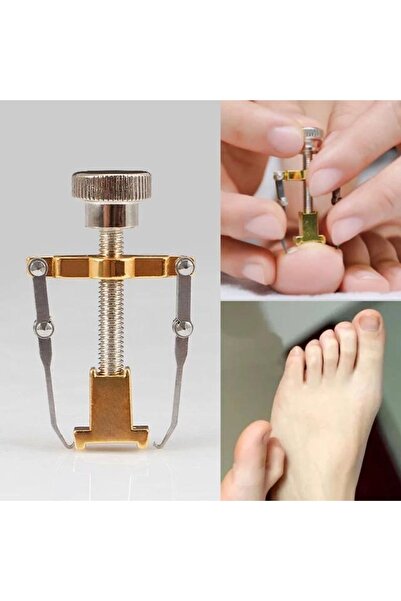 Sensoria Batık Tırnak Çıkartma Aleti Batık Tırnak Düzeltme Batık Tırnak Çıkartıcı Tırnak Batması Önleyici