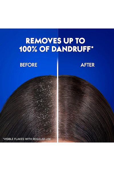 Head&Shoulders Head & Shoulders Smooth and Silky 2in1 Anti-Dandruff Shampoo 1000ml