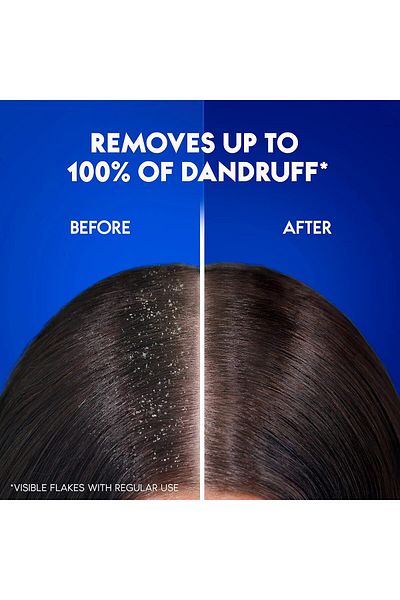Head&Shoulders Head & Shoulders Daily Clean Anti-Dandruff Shampoo, 400 ml, Pack of 2