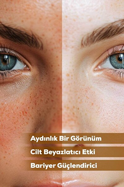 SWELLE صابون الأرز المبيض لتنظيف الوجه وترطيبه، نباتي، صابون فعال ضد البقع الداكنة