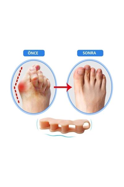 Orkide 5 Parmak Ayırıcı %100 Silikon - Türk Malı