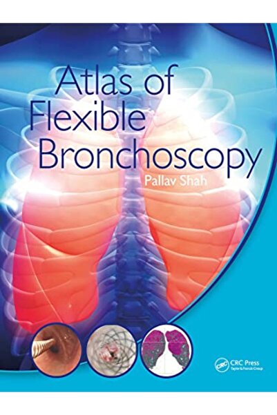 Taylor & Francis Books Ltd Atlas of Flexible Bronchoscopy