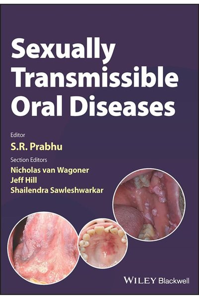 Wiley Sexually Transmissible Oral Diseases