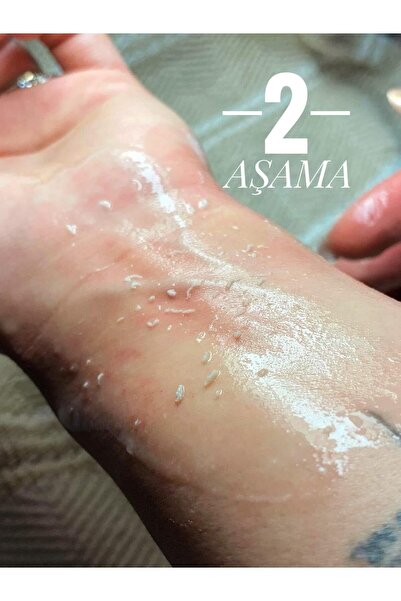 Clemency Peeling Jel 125ml Renk Açıcı Cilt Arındırıcı Beyazlatıcı Gözenek Küçültücü