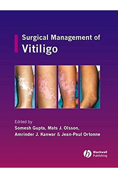 Wiley العلاج الجراحي للبهاق