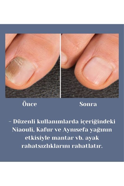April Natural Heel Cream and Foot Cream - Natural Foot Nail Fungus Care Heel Whitening Effective Cream