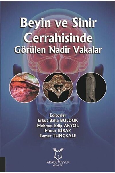 Akademisyen Kitabevi Beyin Ve Sinir Cerrahisinde Görülen Nadir Vakalar