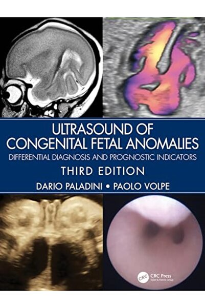 Taylor & Francis Books Ltd الموجات فوق الصوتية للتشوهات الخلقية للجنين والتشخيص التفريقي والمؤشرات التنبؤية