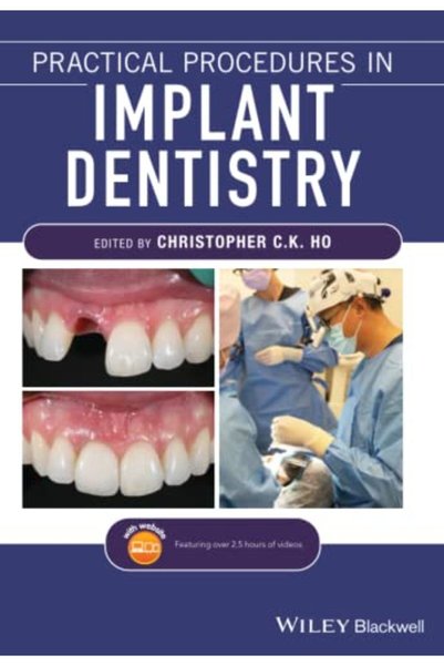 Wiley Practical Procedures In Implant Dentistry