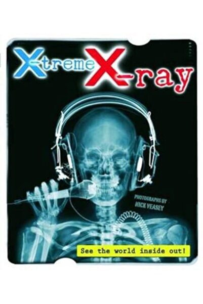 Hachette الأشعة السينية المتطرفة