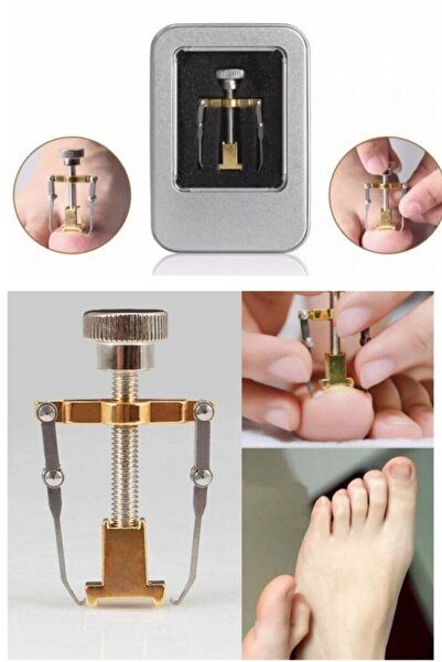 Yayke Batık Tırnak Çıkartıcı Ayak Tırnak Batması Düzeltici Pens Aparatı Orjin...