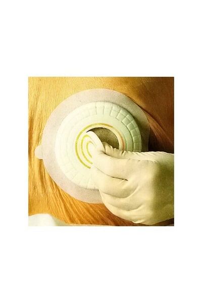 Coloplast Comfeel Plus Pressure Reducing Hydrocolloid Wound Cover 10 Cm 33353 1pc