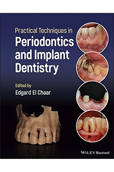 John Wiley Practical Techniques In Periodontics And Implant D Entistry