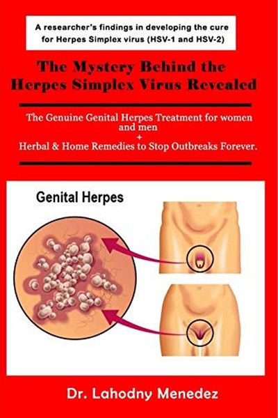 Ingram Mystery Behind The Herpes Simplex Virus Revealed