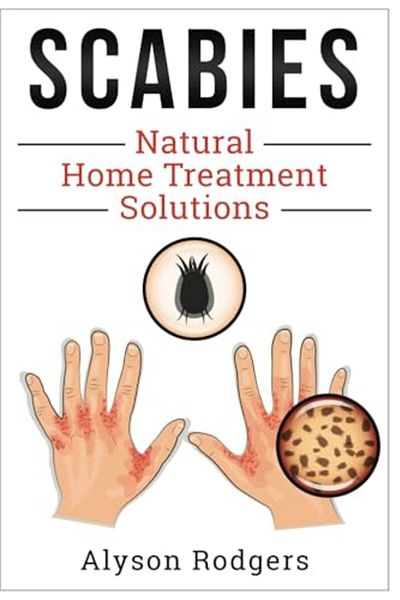 Ingram Scabies Natural Home Treatment Solution