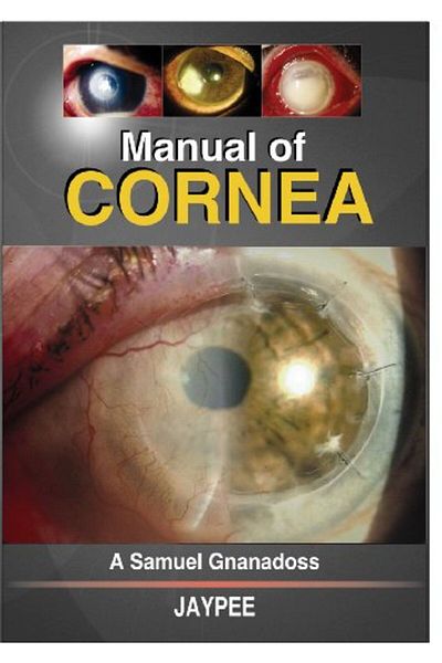 Ingram Manual Of Cornea