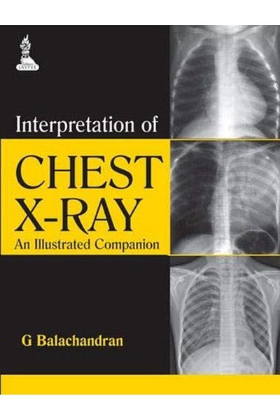Ingram Interpretation Of Chest Xray An Illustrated Companion