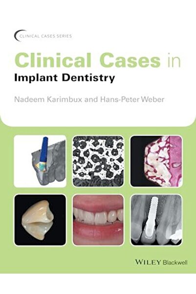 John Wiley Clinical Cases In Implant Dentistry
