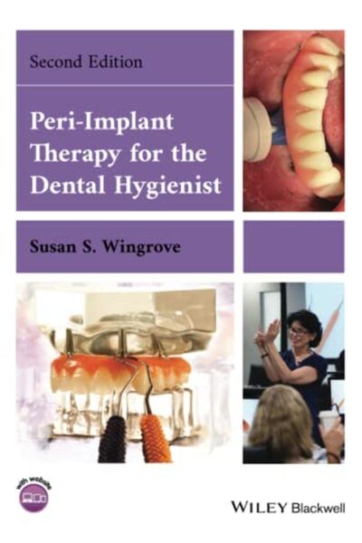 John Wiley العلاج حول زراعة الأسنان لأخصائي صحة الأسنان