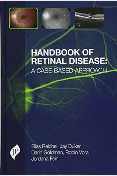 Ingram Handbook Of Retinal Disease A Casebased Approach