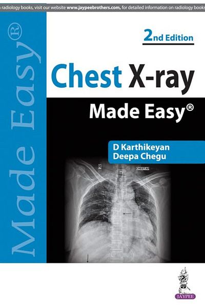Ingram Chest Xray Made Easy