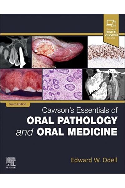 Elsevier أساسيات كاوسون في علم أمراض الفم وطب الفم