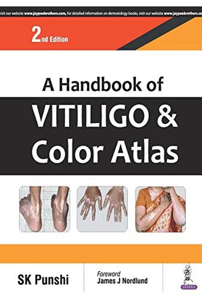 Ingram A Handbook Of Vitiligo & Color Atlas