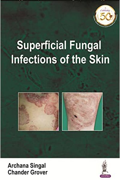 Ingram Superficial Fungal Infections Of The Skin