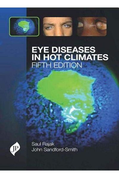 Ingram Eye Diseases In Hot Climates