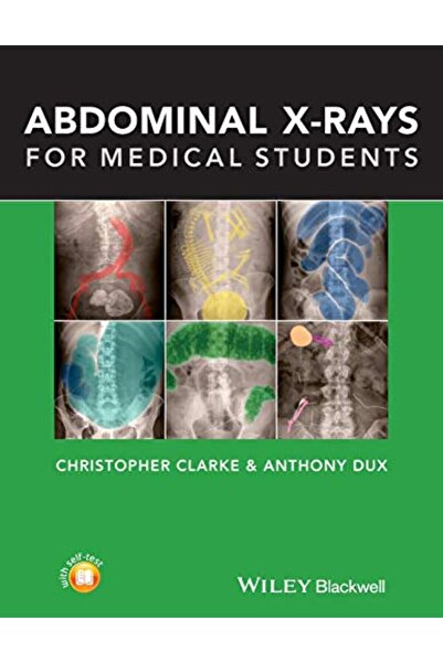John Wiley الأشعة السينية على البطن لطلاب الطب