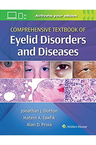 Wolters Kluwer كتاب شامل عن أمراض واضطرابات الجفن