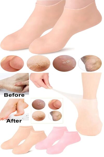 AYGÖREN HOME Silikon Ayak Bakım Çorabı Nemlendirici Jel Çorap Çatlak Önleyici Ölü Deri Atıcı Çorap Ayak Bakımı