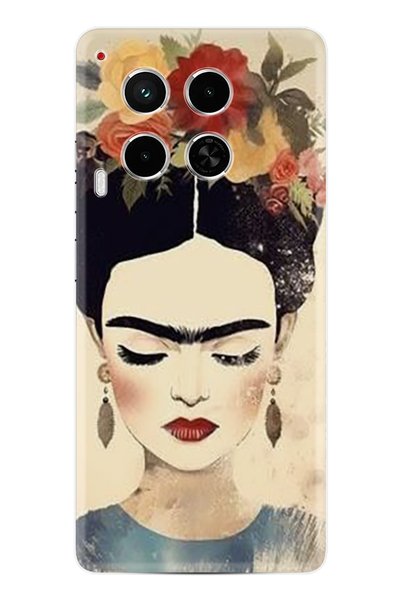 TECNO حافظة كامون 30 4G سلسلة داكنة تكنو--Camon304G-41-camon30