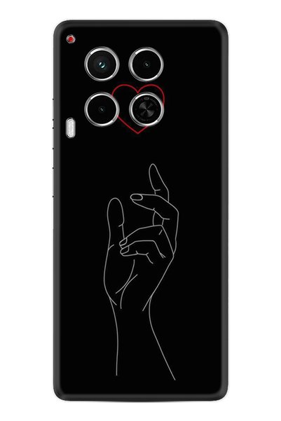 TECNO Camon 30 Case Cover Hd Patterned Millennium Series Xt-Camon304G-1-Camon30