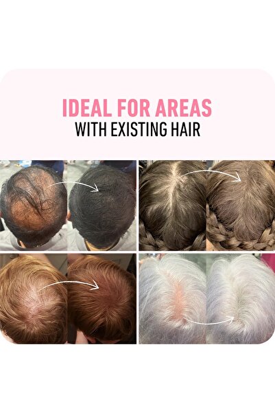 Boldify Saç Dolgunlaştırıcı Fiber, Topik Tozu Koyu Kahve 12 gr- Hair Building Fibers