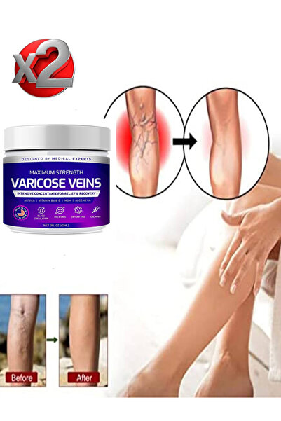 HİNTOHU Varicose Veins Purple Krem Sılulıt ve karsıtı 100 ml x 2 ad