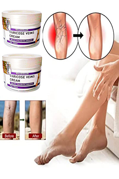 HİNTOHU Varicose and Spider Veins Soothing Leg Cream Bacak Bakım Kremi 100 ml X 2 adet