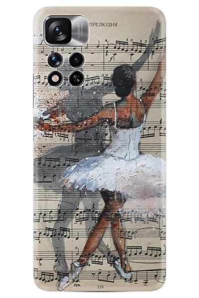 Arvencase Xiaomiredmi Note 11 Pro Case Hd Printed Pattern Happy Series Xt-Rn ...