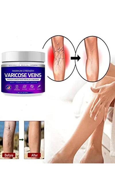 TAMNET Maximum Strength Varicose Veins Bakım Kremi 100 ml