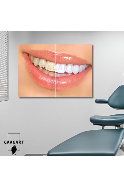 GAAGART Tekli Yatay Kanvas Diş Sağlığı Poliklinik Tablo Dekoratif Diş