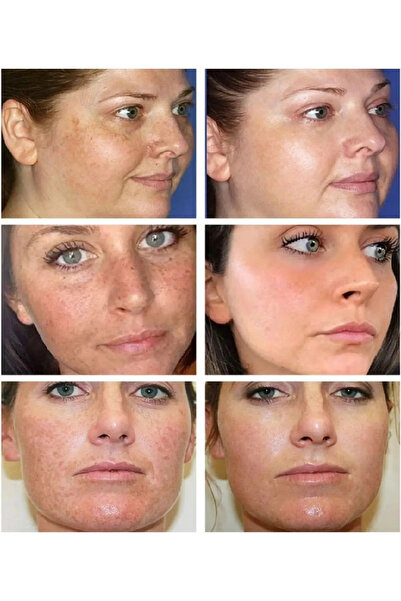 KAİZEN Mrd Beyazlatıcı Krem Sabun Ve Serum Seti 3'lü Set