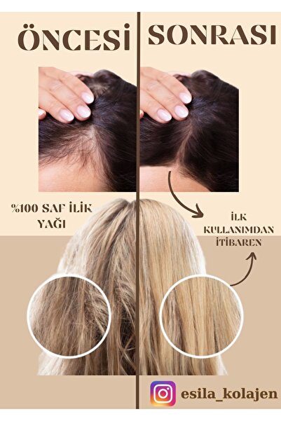 ESİLA KOLAJEN %100 Saf Ilik Yağı Bakımı - 1 Adet 40 Ml - Saç Dökülmesine Mucize Etki - Aylık Kür