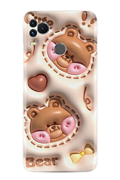 omix OMİX X400 Kılıf HD Baskılı Desenli Paris Seri xt-gtomix STK-407-omixX400