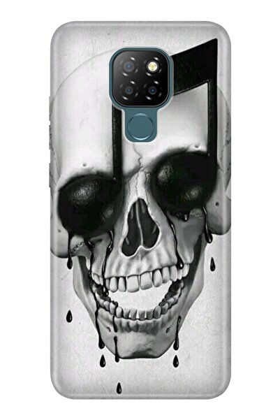 General Mobile Gm 20 Kılıf 0.4mm Lazer Kesim Silikon Kapak Müzisyen Iskelet