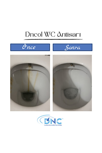 DNC Wc Lavabo Temizleyici Sarı -ol Wc Antisarı 1.2