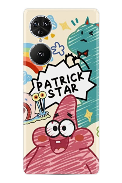 Reeder S19 Max Pro S EDGE Kılıf Kapak HD Desenli Baskılı xt-reeder rg43kl STK...