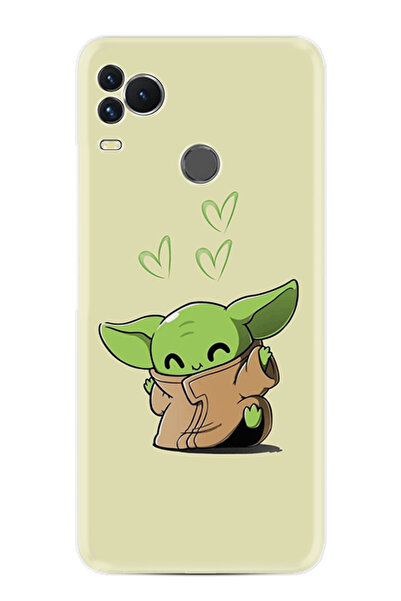 omix OMİX X400 Kılıf HD Baskılı Desenli Paris Seri xt-gtomix STK-406-omixX400